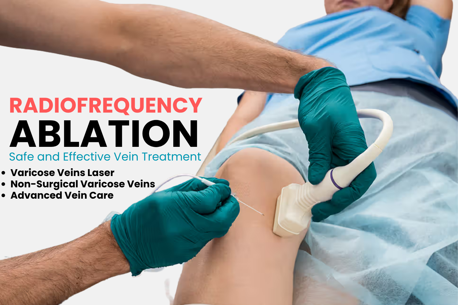 Best Radiofrequency Ablation Treatment in Faridabad for Varicose Veins