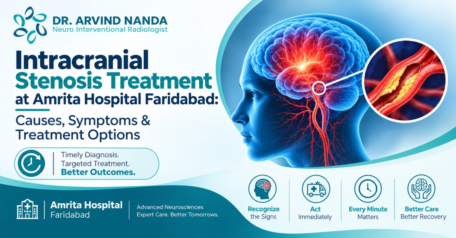 Intracranial Stenosis Treatment at Amrita Hospital Faridabad: Causes, Symptoms & Treatment Options