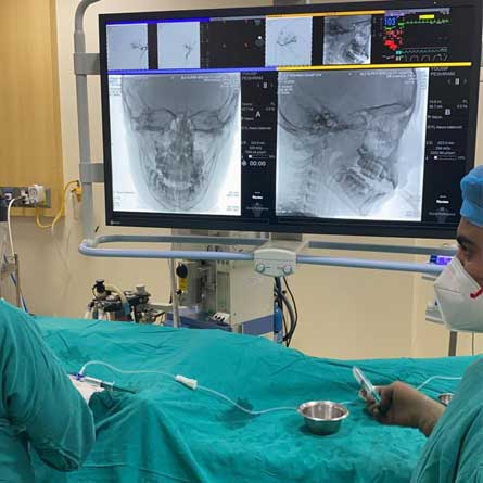 Carotid Artery Stenosis